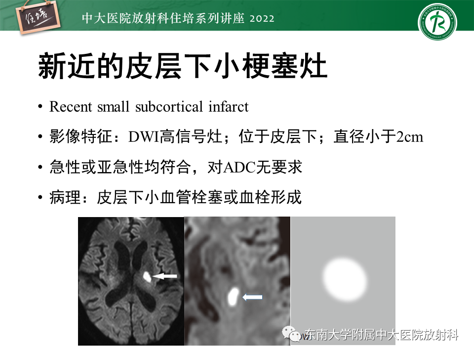 影像PPT - 【PPT】脑小血管病概念、影像维度及其深度学习进展-7
