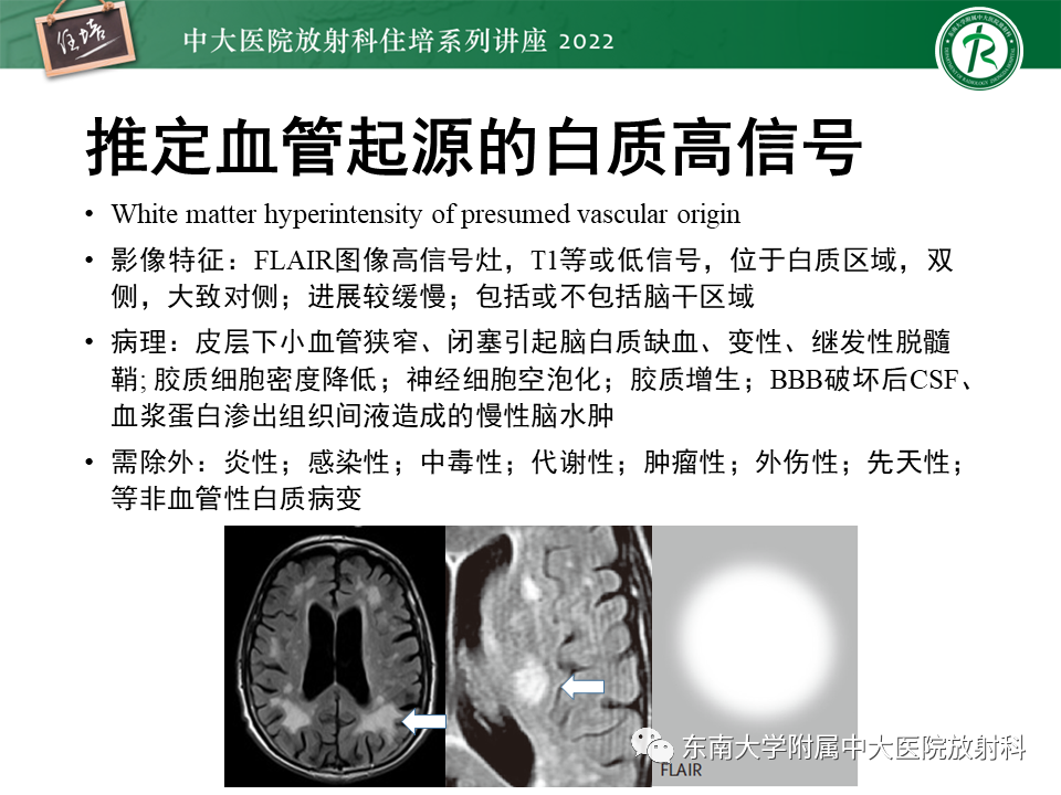 影像PPT - 【PPT】脑小血管病概念、影像维度及其深度学习进展-8