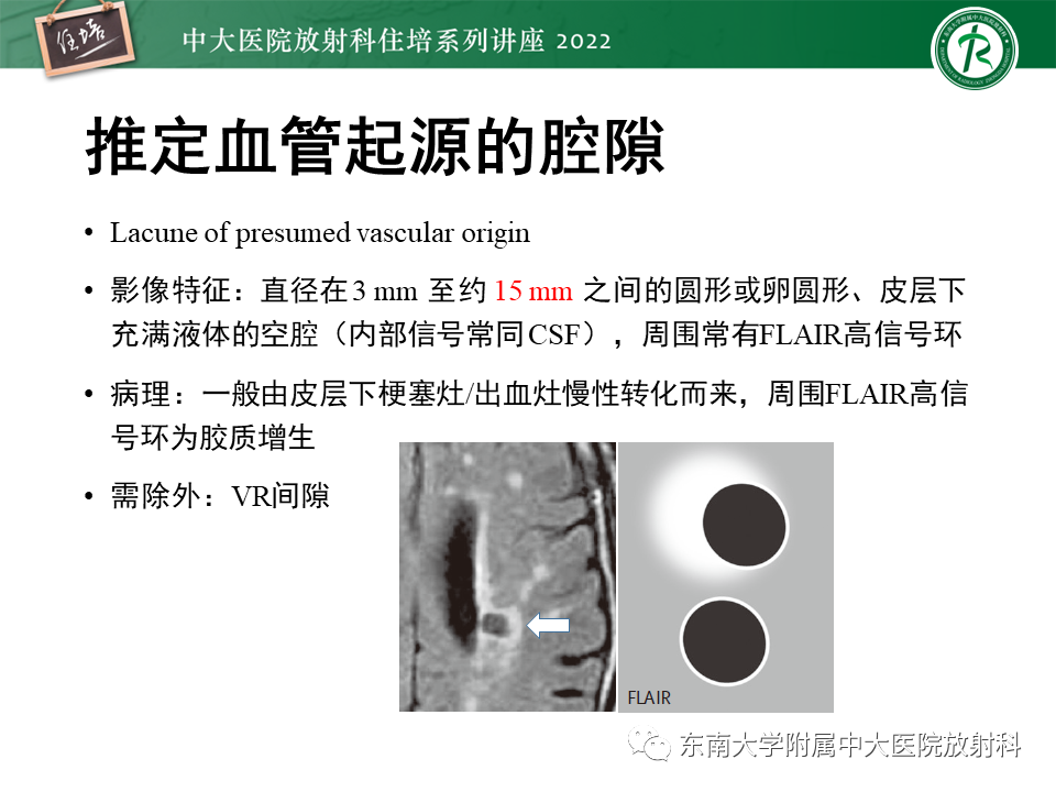 影像PPT - 【PPT】脑小血管病概念、影像维度及其深度学习进展-9