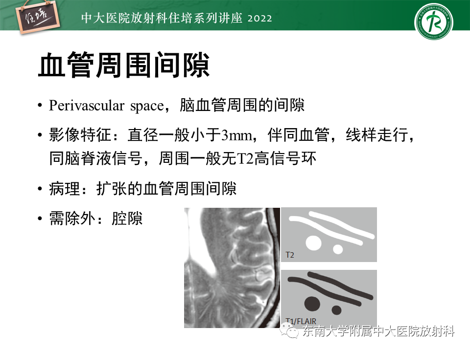 影像PPT - 【PPT】脑小血管病概念、影像维度及其深度学习进展-10