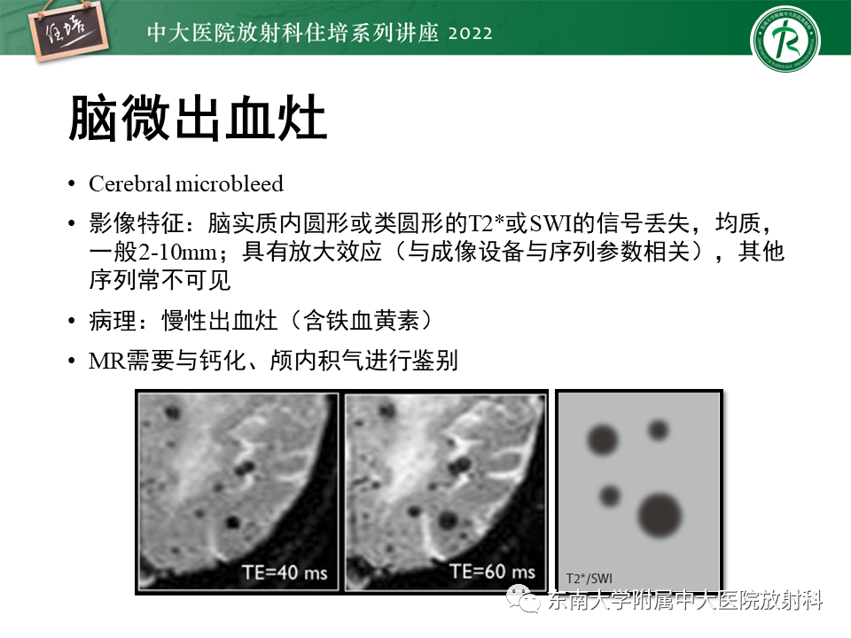 影像PPT - 【PPT】脑小血管病概念、影像维度及其深度学习进展-11