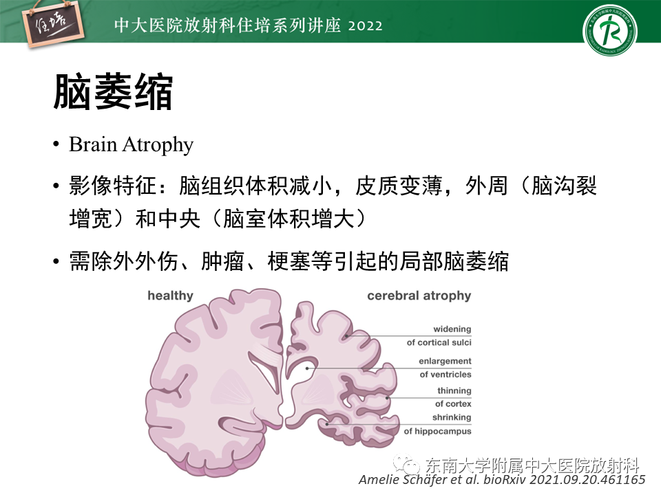 影像PPT - 【PPT】脑小血管病概念、影像维度及其深度学习进展-12