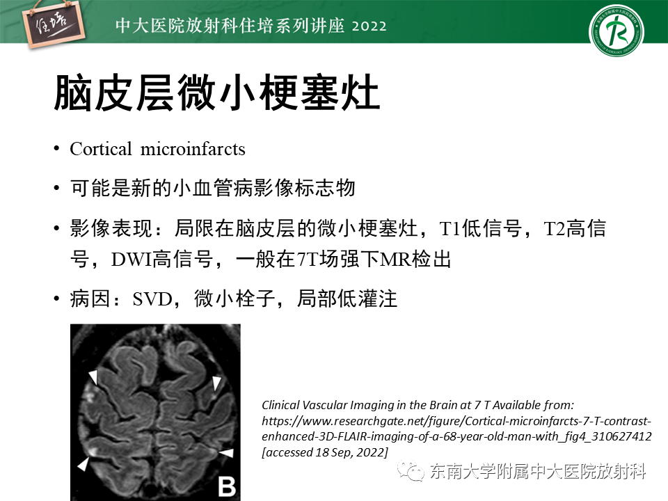 影像PPT - 【PPT】脑小血管病概念、影像维度及其深度学习进展-14