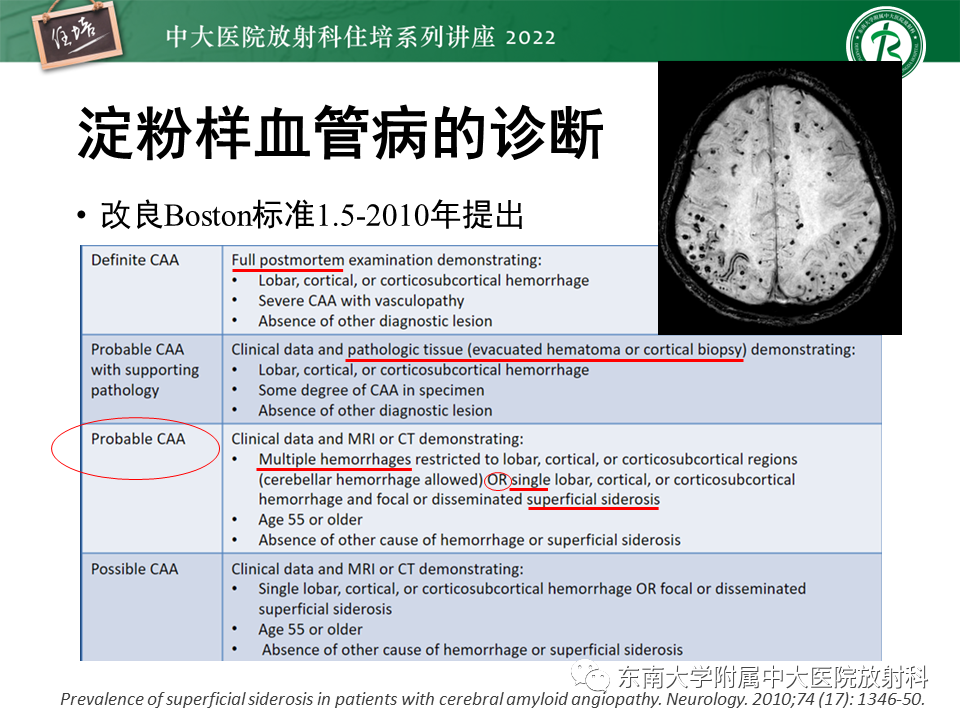 影像PPT - 【PPT】脑小血管病概念、影像维度及其深度学习进展-15