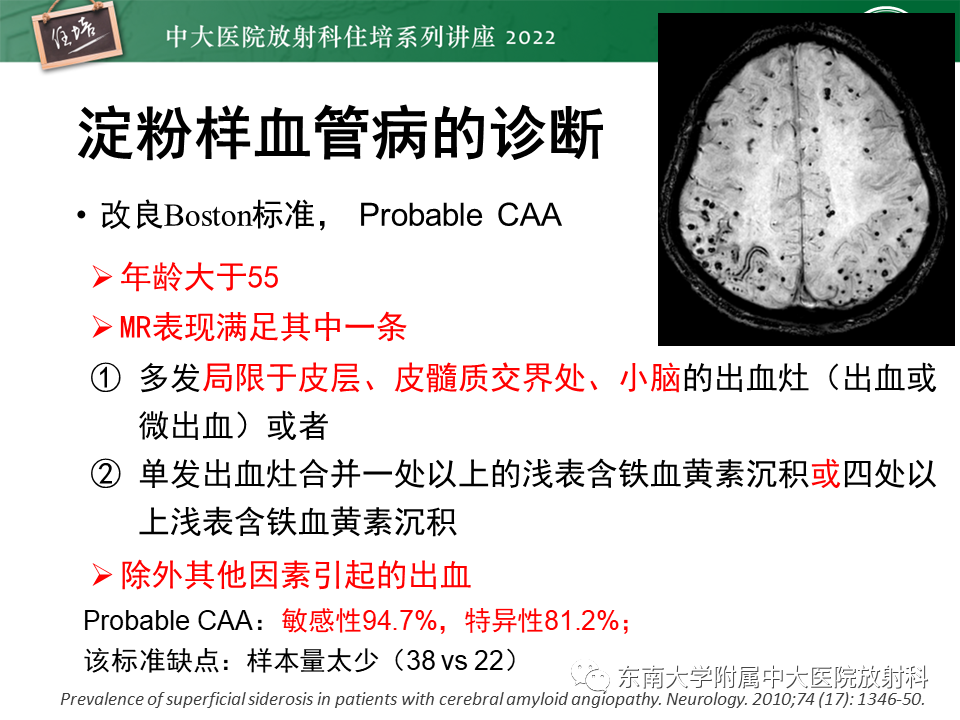 影像PPT - 【PPT】脑小血管病概念、影像维度及其深度学习进展-16