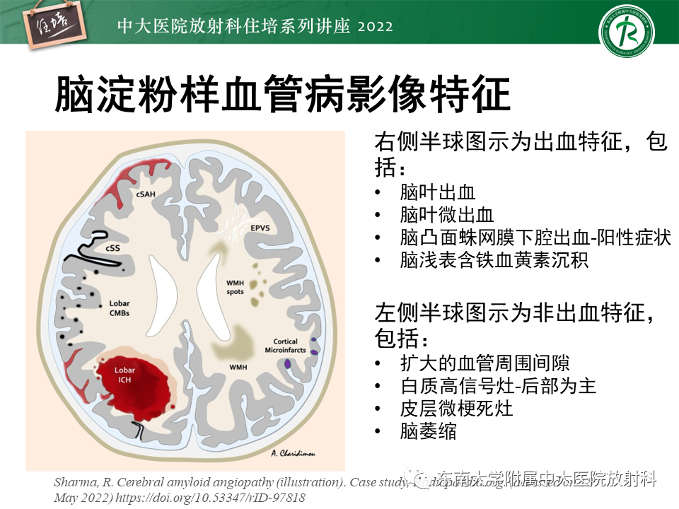 影像PPT - 【PPT】脑小血管病概念、影像维度及其深度学习进展-18