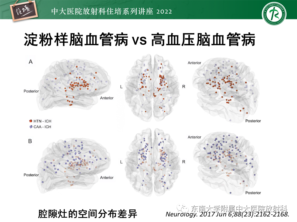 影像PPT - 【PPT】脑小血管病概念、影像维度及其深度学习进展-23