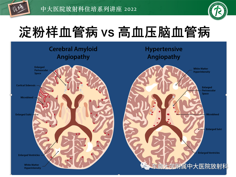 影像PPT - 【PPT】脑小血管病概念、影像维度及其深度学习进展-22