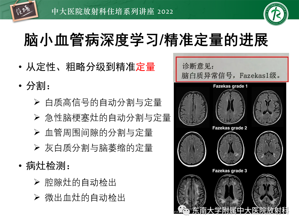 影像PPT - 【PPT】脑小血管病概念、影像维度及其深度学习进展-24