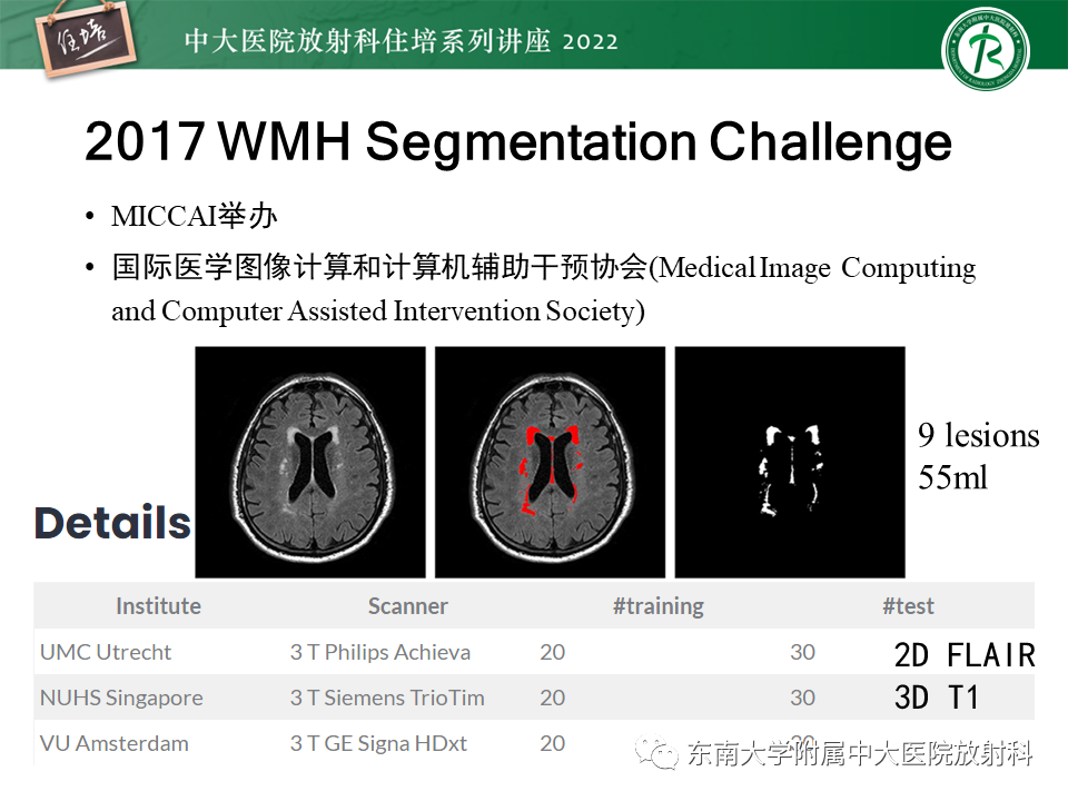 影像PPT - 【PPT】脑小血管病概念、影像维度及其深度学习进展-25