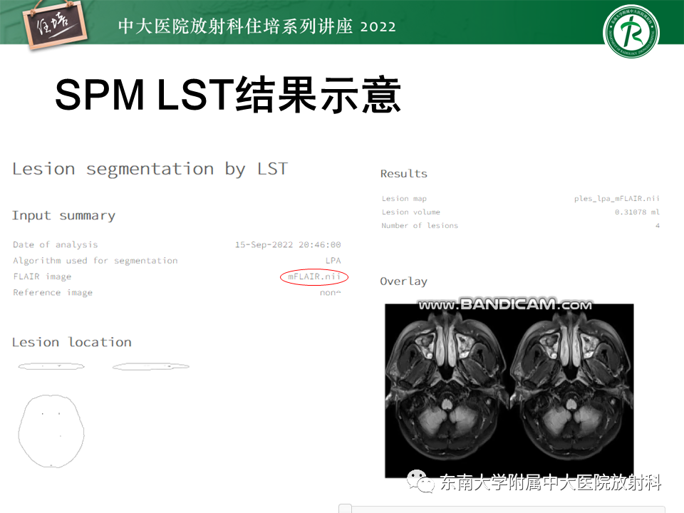 影像PPT - 【PPT】脑小血管病概念、影像维度及其深度学习进展-28