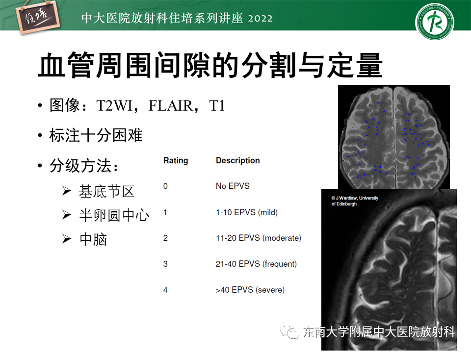 影像PPT - 【PPT】脑小血管病概念、影像维度及其深度学习进展-30