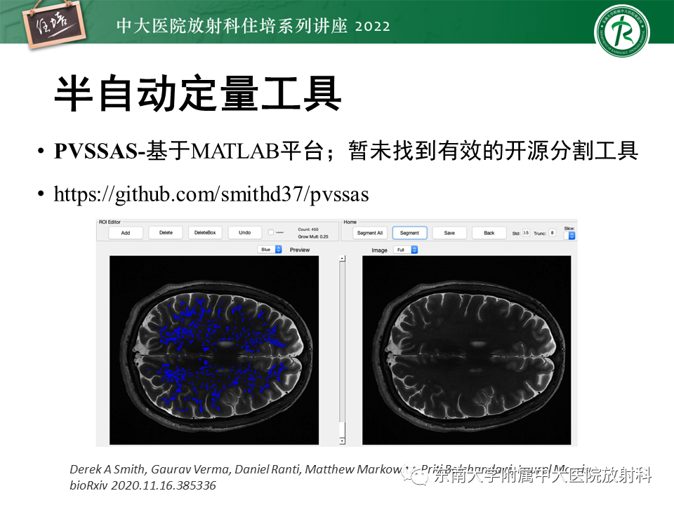影像PPT - 【PPT】脑小血管病概念、影像维度及其深度学习进展-31