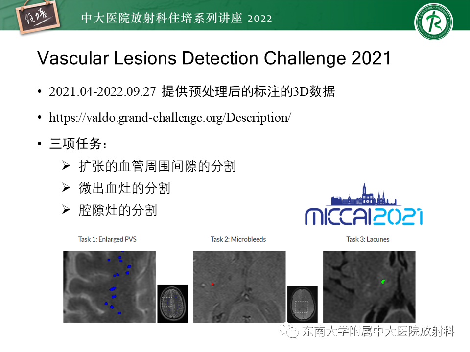影像PPT - 【PPT】脑小血管病概念、影像维度及其深度学习进展-32