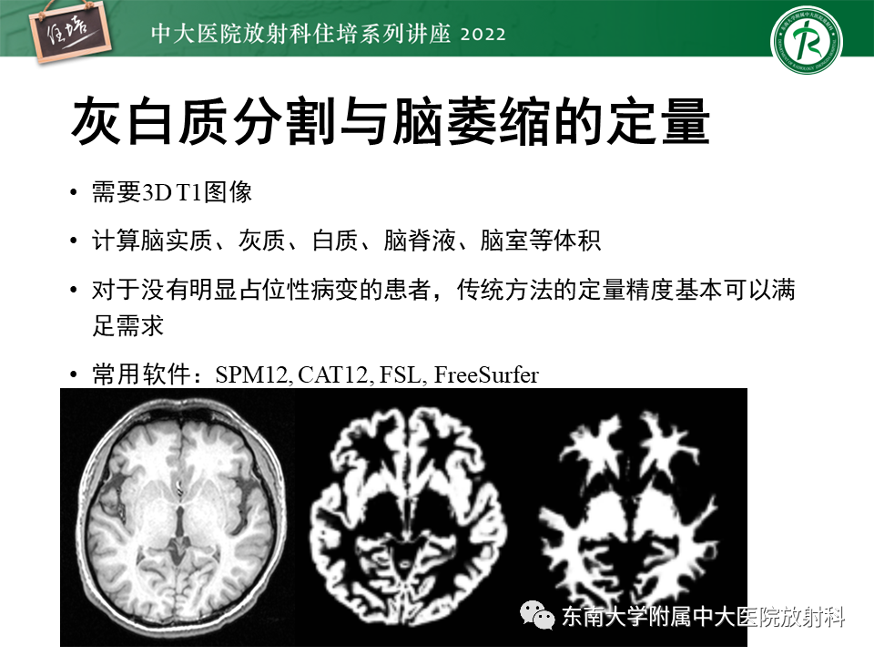 影像PPT - 【PPT】脑小血管病概念、影像维度及其深度学习进展-33