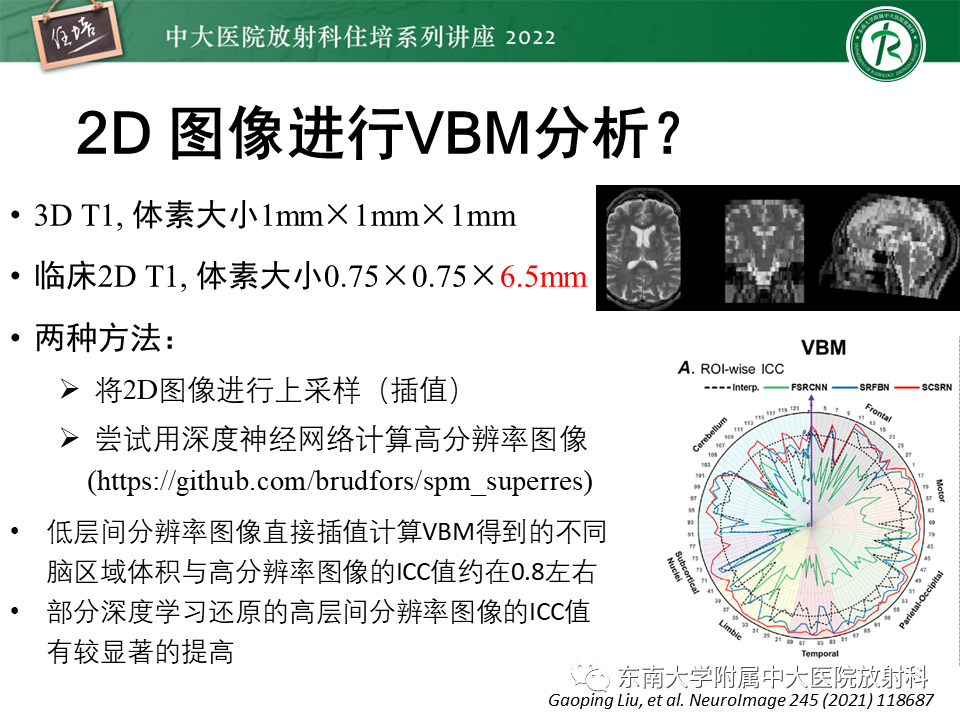 影像PPT - 【PPT】脑小血管病概念、影像维度及其深度学习进展-35