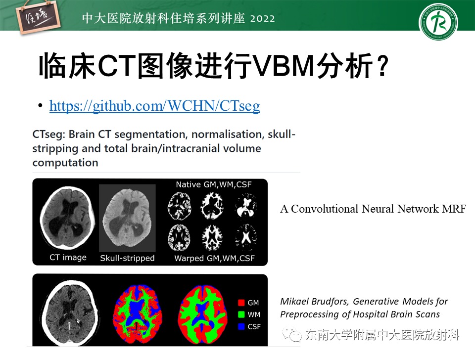 影像PPT - 【PPT】脑小血管病概念、影像维度及其深度学习进展-36