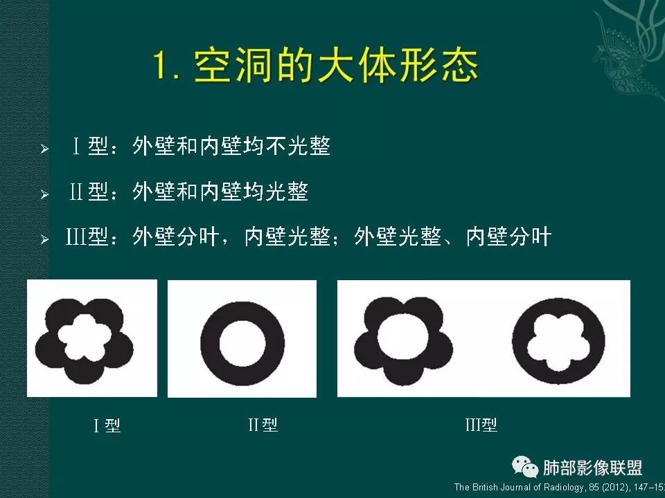 影像PPT - 【PPT】空洞型肺癌的影像诊断及鉴别-12