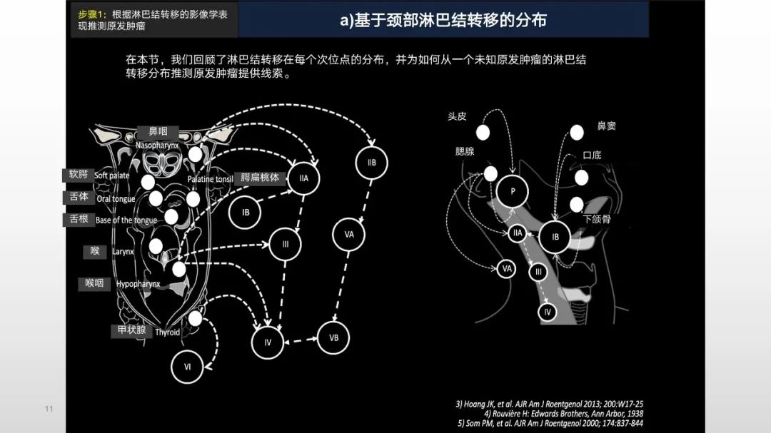 影像PPT - 【PPT】原发肿瘤在哪里？不明原发肿瘤颈部淋巴结转移的影像学检查方法-11
