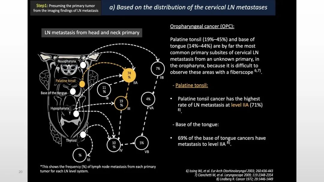 影像PPT - 【PPT】原发肿瘤在哪里？不明原发肿瘤颈部淋巴结转移的影像学检查方法-20