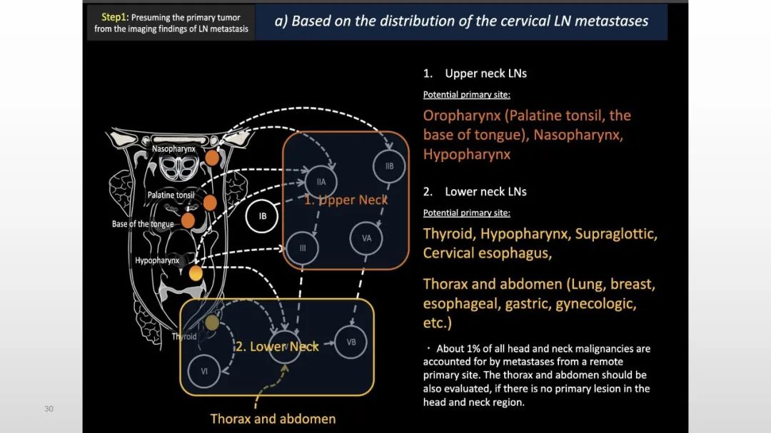 影像PPT - 【PPT】原发肿瘤在哪里？不明原发肿瘤颈部淋巴结转移的影像学检查方法-30