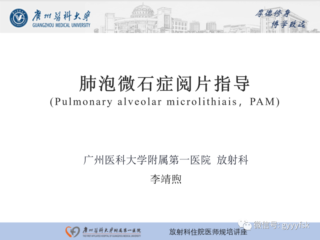 影像PPT - 【PPT】肺泡微石症阅片指导-1