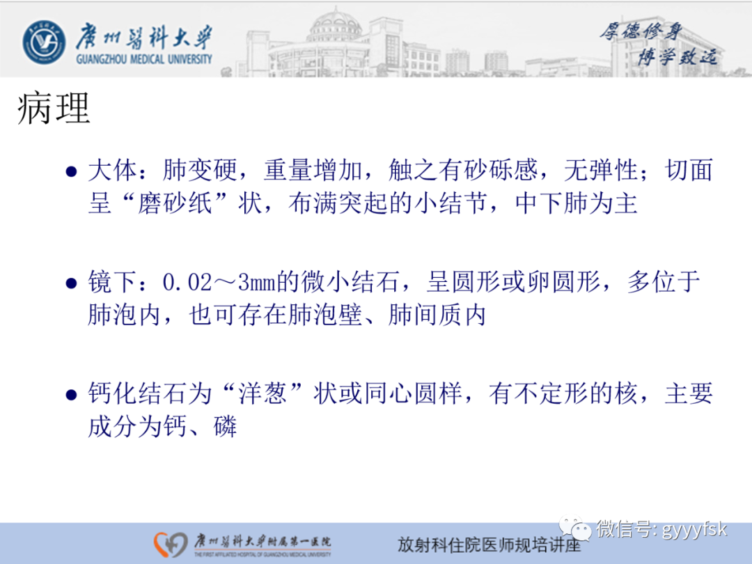 影像PPT - 【PPT】肺泡微石症阅片指导-5