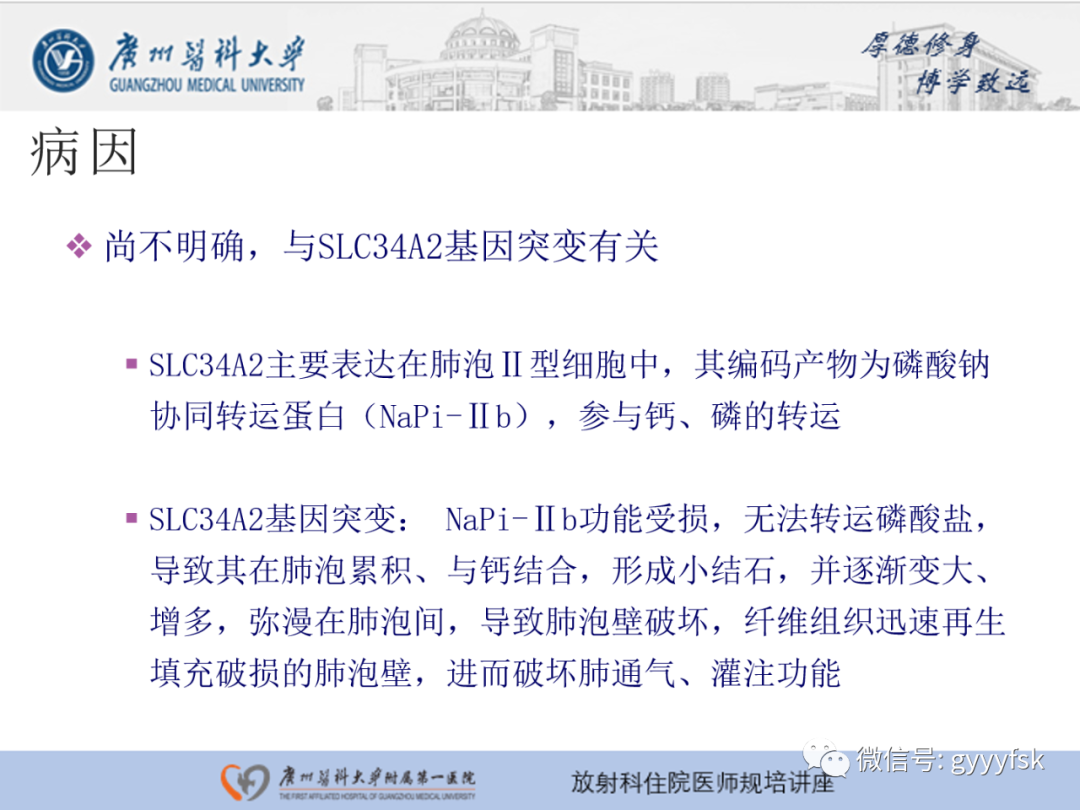 影像PPT - 【PPT】肺泡微石症阅片指导-4