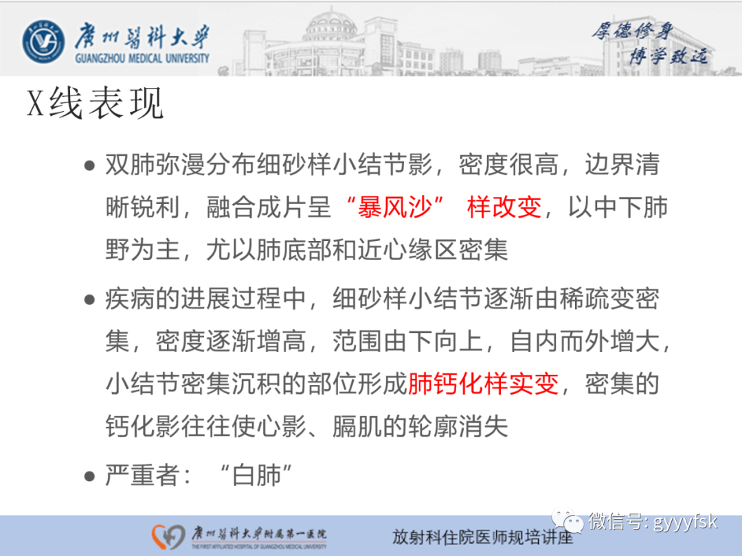 影像PPT - 【PPT】肺泡微石症阅片指导-11