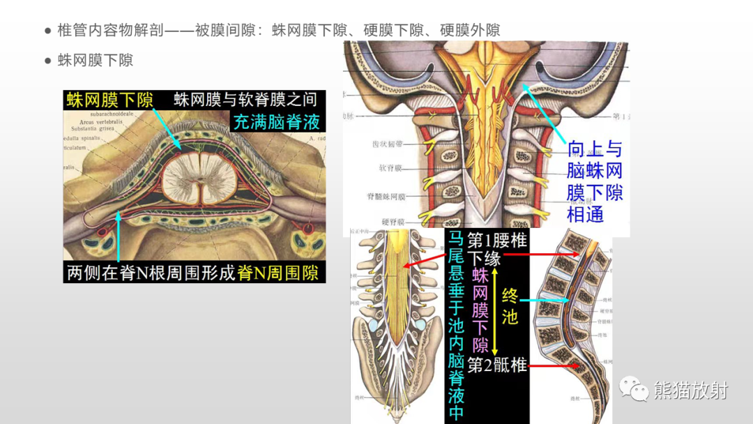 影像PPT - 【病例】脊膜瘤2例MR影像-14