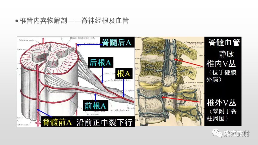 影像PPT - 【病例】脊膜瘤2例MR影像-18