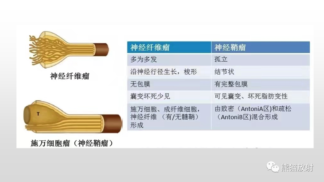 影像PPT - 【病例】脊膜瘤2例MR影像-28