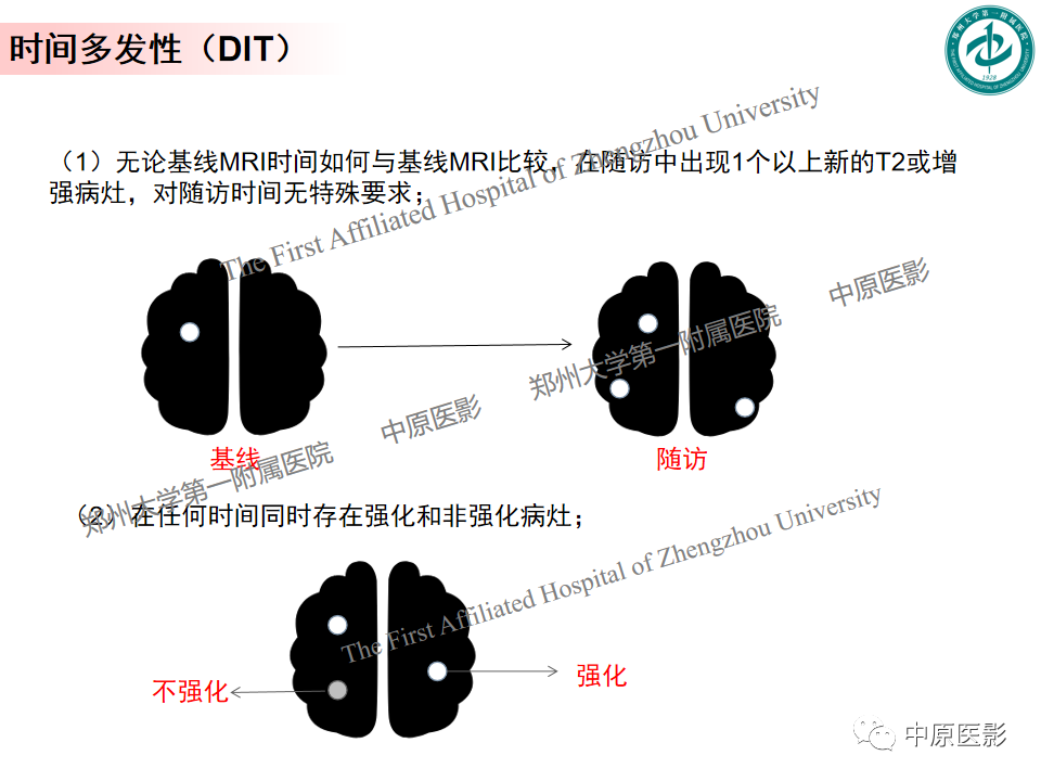 影像PPT - 【PPT】视神经脊髓炎与多发性硬化鉴别诊断-22