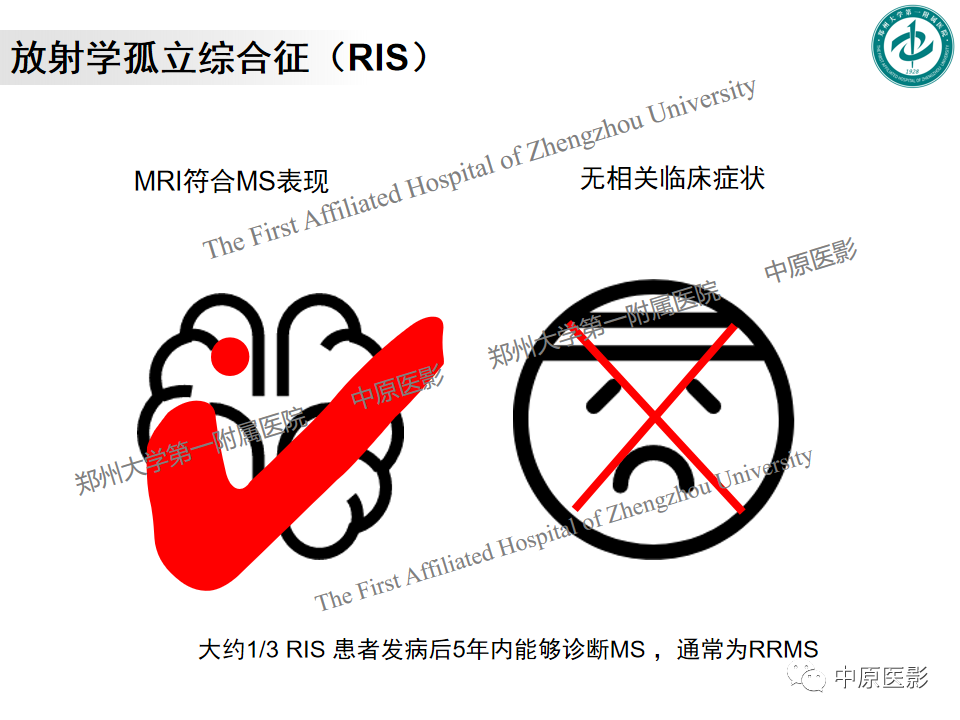 影像PPT - 【PPT】视神经脊髓炎与多发性硬化鉴别诊断-25