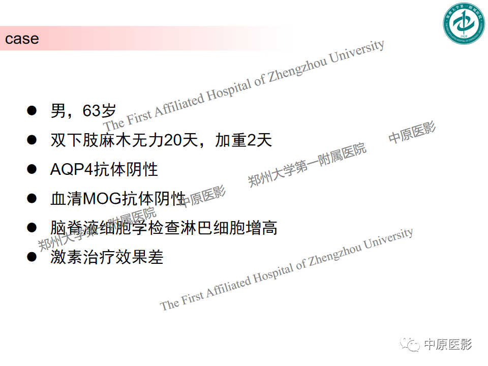 影像PPT - 【PPT】视神经脊髓炎与多发性硬化鉴别诊断-48
