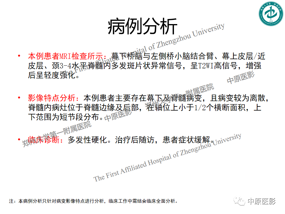 影像PPT - 【PPT】视神经脊髓炎与多发性硬化鉴别诊断-53