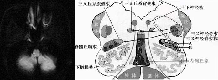 影像PPT - 【病例】肢体麻木,定位可千万别漏掉这个地方-7 影像PPT - 【病例】肢体麻木,定位可千万别漏掉这个地方-7