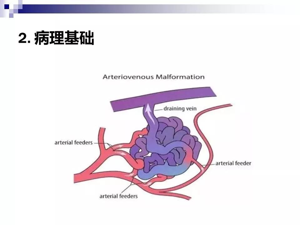 影像PPT - 各类脑血管畸形的病理基础、临床、影像学表现-6