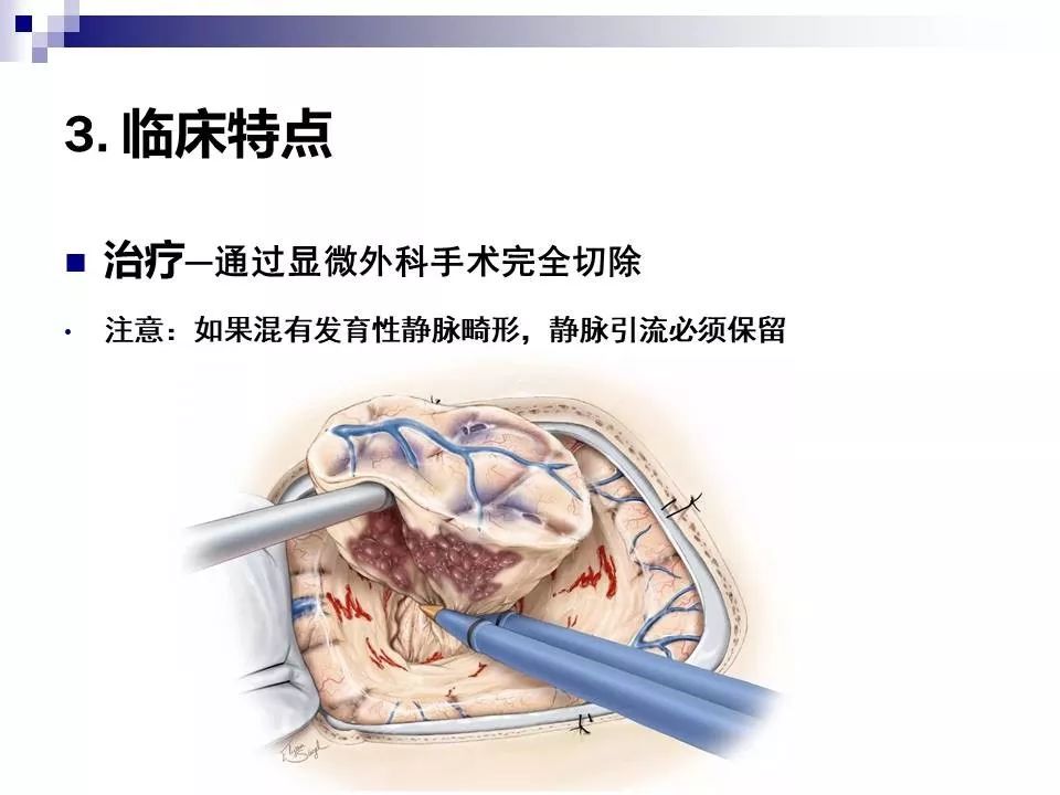 影像PPT - 各类脑血管畸形的病理基础、临床、影像学表现-49