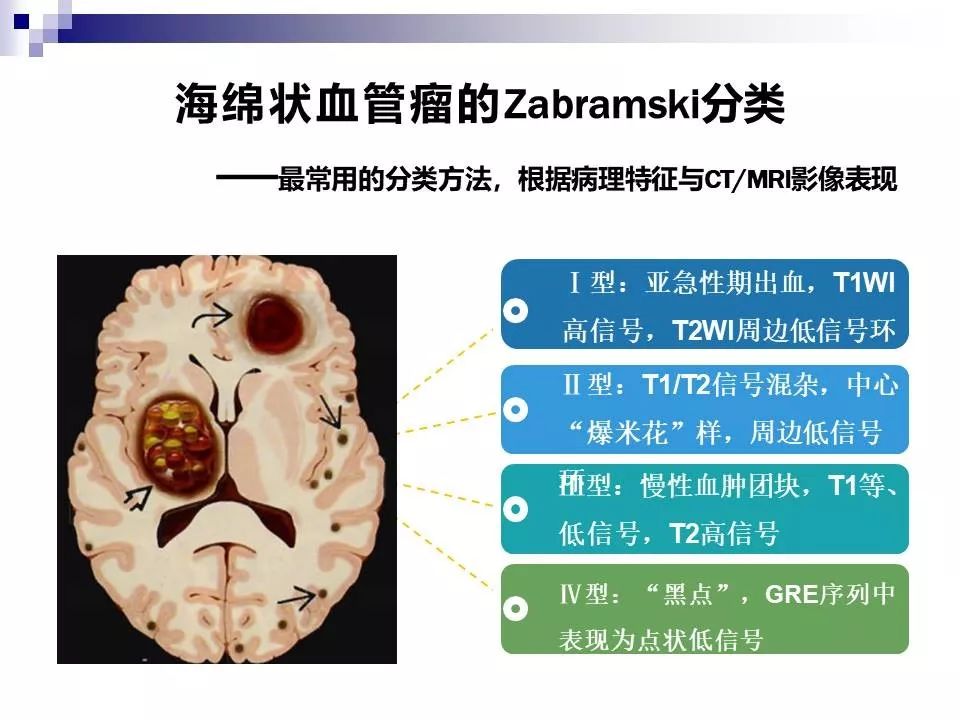 影像PPT - 各类脑血管畸形的病理基础、临床、影像学表现-54