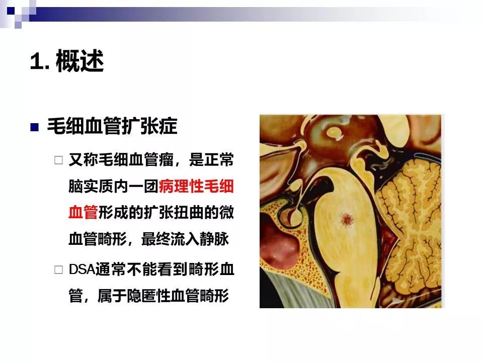 影像PPT - 各类脑血管畸形的病理基础、临床、影像学表现-63