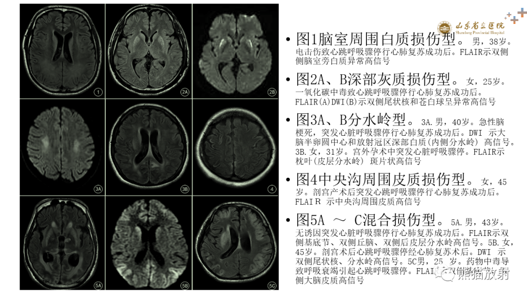 影像PPT - 【PPT】成人缺氧缺血性脑病影像学表现-24
