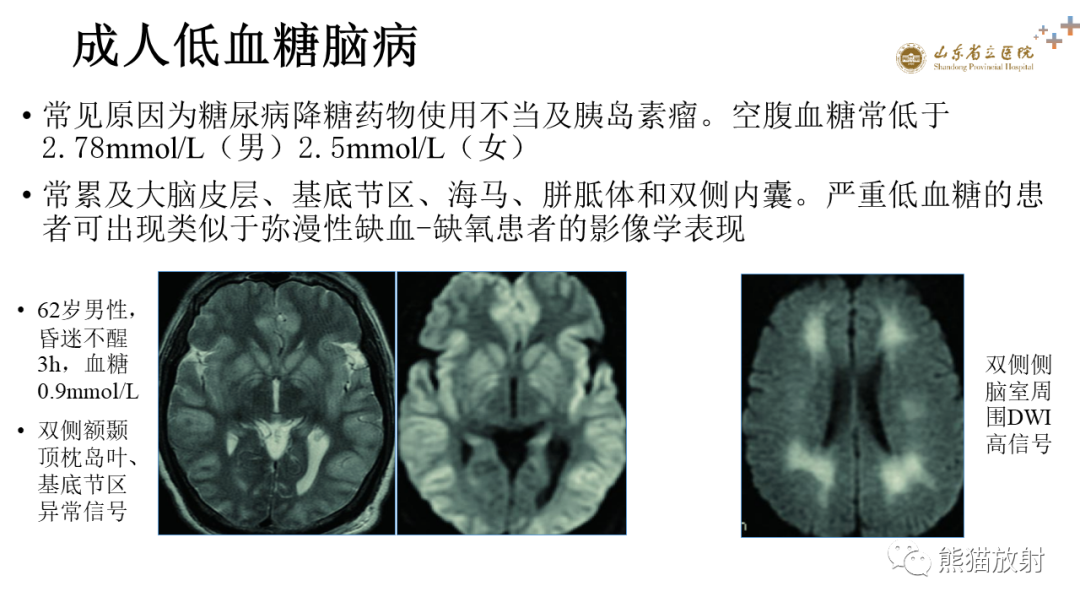 影像PPT - 【PPT】成人缺氧缺血性脑病影像学表现-27