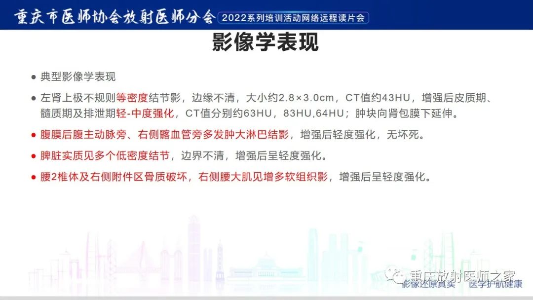 影像PPT - 【病例】肾脏淋巴瘤1例CT影像-5