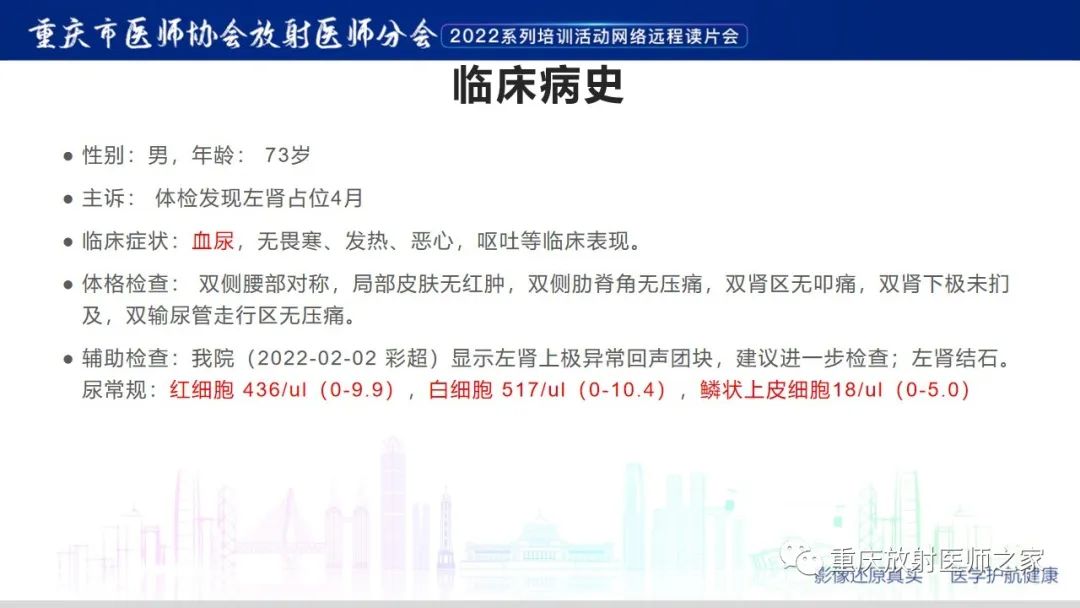 影像PPT - 【病例】肾脏淋巴瘤1例CT影像-2