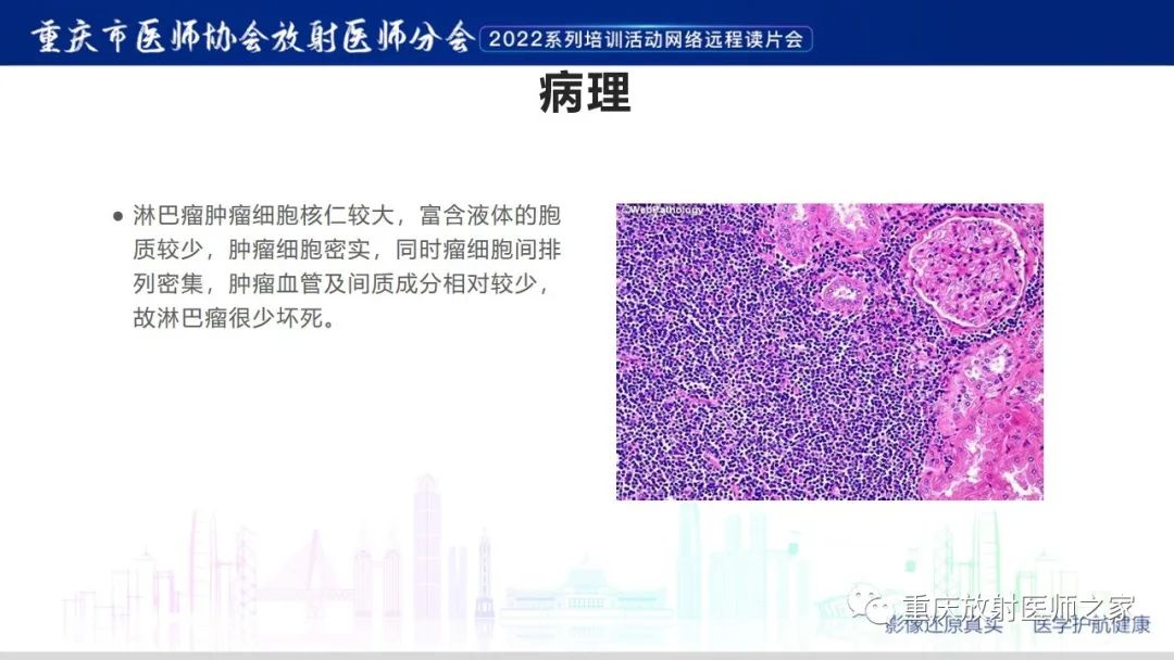 影像PPT - 【病例】肾脏淋巴瘤1例CT影像-9