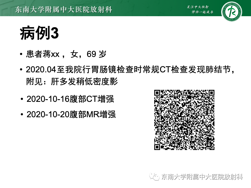 影像PPT - 【PPT】肝内多房囊性占位病例随访-5