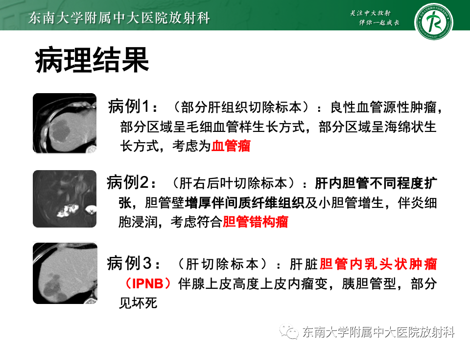 影像PPT - 【PPT】肝内多房囊性占位病例随访-7