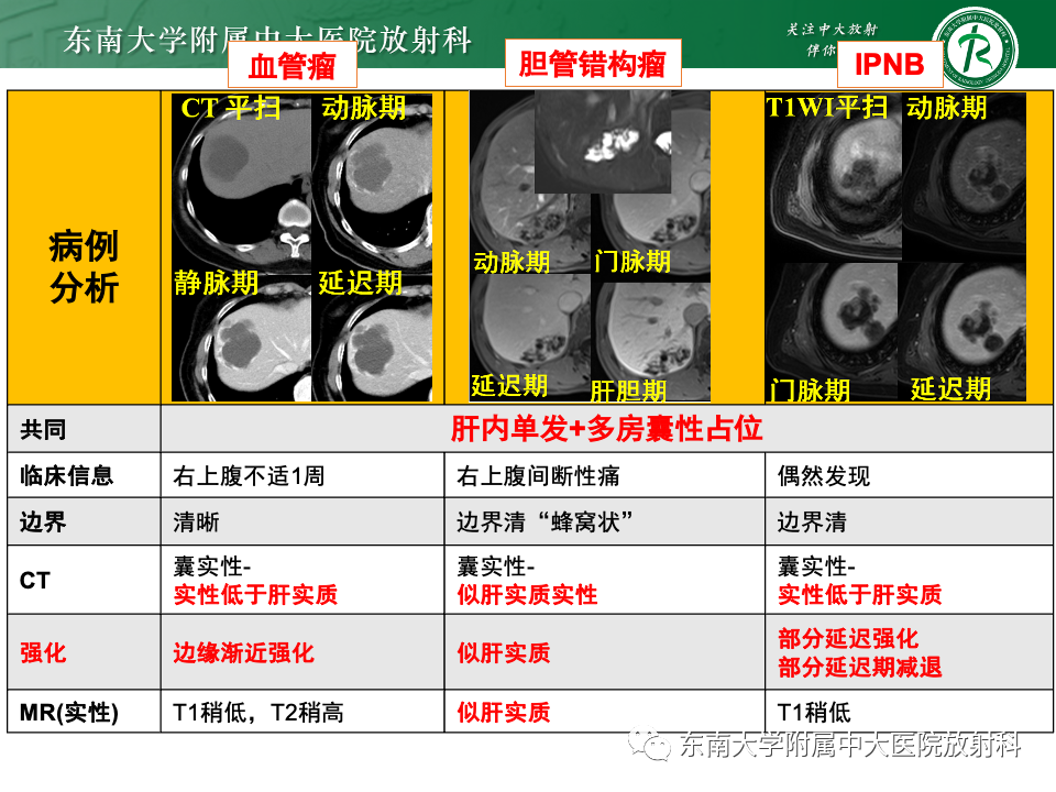 影像PPT - 【PPT】肝内多房囊性占位病例随访-11