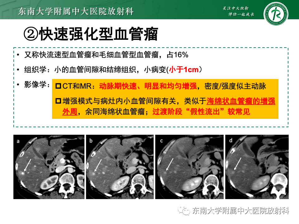 影像PPT - 【PPT】肝内多房囊性占位病例随访-16